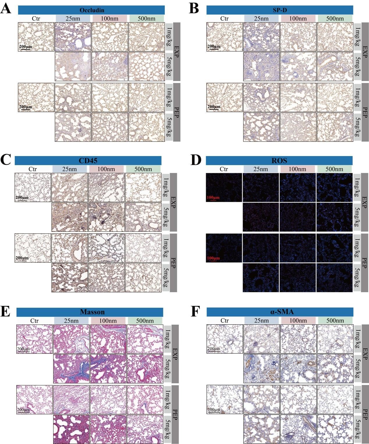 Study Reports Sustained Pulmonary Injury Induced by Repeated Exposure to Polystyrene Nanoplastics in Mice
